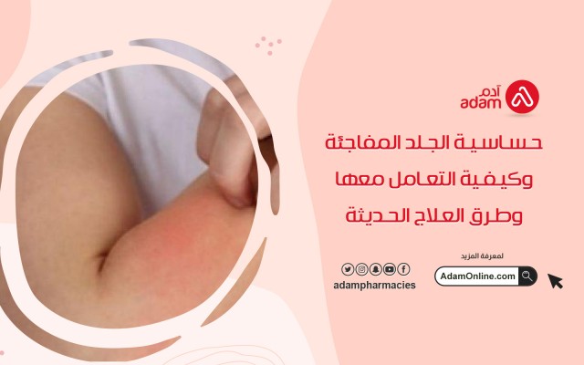 حساسية الجلد المفاجئة وكيفية التعامل معها وطرق العلاج الحديثة